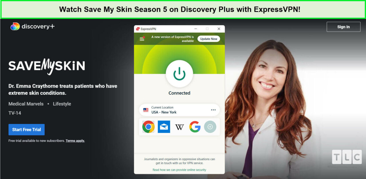 expressvpn-unblocks-save-my-skin-season-five-on-discovery-plus-in-Italy